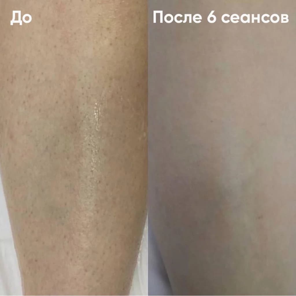 BeautуZona